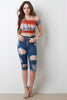 Distressed Five Button High Waisted Bermuda Denim Shorts